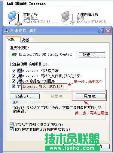 怎么设置本地连接ip